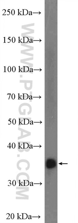 FBP1 Rabbit anti-Human, Mouse, Rat, Polyclonal, Proteintech:Antibodies:Primary