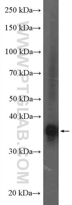FBP1 Rabbit anti-Human, Mouse, Rat, Polyclonal, Proteintech:Antibodies:Primary