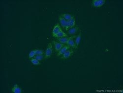 FBXO17 Rabbit anti-Human, Mouse, Rat, Polyclonal, Proteintech 150 &mu;L;