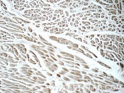 FBXO17 Rabbit anti-Human, Mouse, Rat, Polyclonal, Proteintech 150 &mu;L;