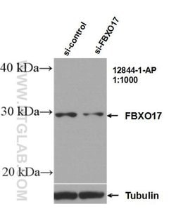 FBXO17 Rabbit anti-Human, Mouse, Rat, Polyclonal, Proteintech 150 &mu;L;