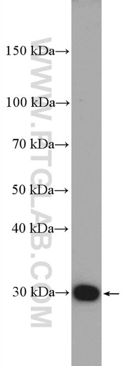 FBXO17 Rabbit anti-Human, Mouse, Rat, Polyclonal, Proteintech 150 &mu;L;