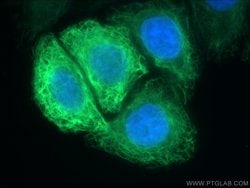 FBXO17 Rabbit anti-Human, Mouse, Rat, Polyclonal, Proteintech 150 &mu;L;