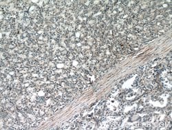 FBXO17 Rabbit anti-Human, Mouse, Rat, Polyclonal, Proteintech 150 &mu;L;