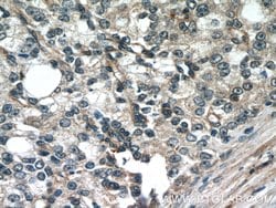 FBXO17 Rabbit anti-Human, Mouse, Rat, Polyclonal, Proteintech 150 &mu;L;