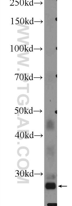 FBXO17 Rabbit anti-Human, Mouse, Rat, Polyclonal, Proteintech 150 &mu;L;