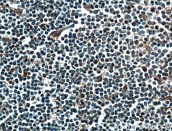 CMIP Rabbit anti-Human, Polyclonal, Proteintech 150 &mu;L; Unconjugated:Antibodies,