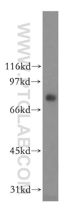 CMIP Rabbit anti-Human, Polyclonal, Proteintech 150 &mu;L; Unconjugated:Antibodies,