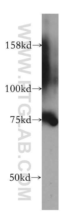 CMIP Rabbit anti-Human, Polyclonal, Proteintech 150 &mu;L; Unconjugated:Antibodies,