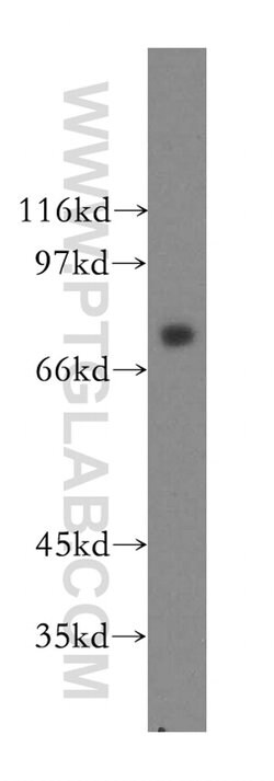 CMIP Rabbit anti-Human, Polyclonal, Proteintech 150 &mu;L; Unconjugated:Antibodies,