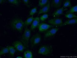 STK33 Rabbit anti-Human, Mouse, Rat, Polyclonal, Proteintech:Antibodies:Primary