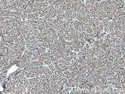 STK33 Rabbit anti-Human, Mouse, Rat, Polyclonal, Proteintech:Antibodies:Primary