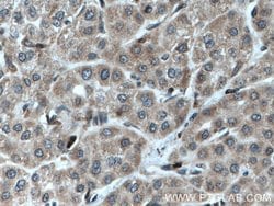 STK33 Rabbit anti-Human, Mouse, Rat, Polyclonal, Proteintech:Antibodies:Primary