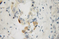 STK33 Rabbit anti-Human, Mouse, Rat, Polyclonal, Proteintech:Antibodies:Primary
