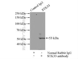 STK33 Rabbit anti-Human, Mouse, Rat, Polyclonal, Proteintech:Antibodies:Primary