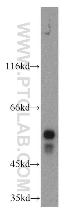 STK33 Rabbit anti-Human, Mouse, Rat, Polyclonal, Proteintech:Antibodies:Primary