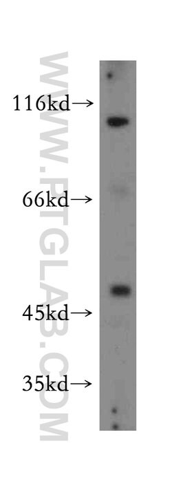 STK33 Rabbit anti-Human, Mouse, Rat, Polyclonal, Proteintech:Antibodies:Primary