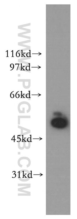 STK33 Rabbit anti-Human, Mouse, Rat, Polyclonal, Proteintech:Antibodies:Primary