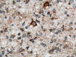 STOML1 Rabbit anti-Human, Mouse, Rat, Polyclonal, Proteintech:Antibodies:Primary