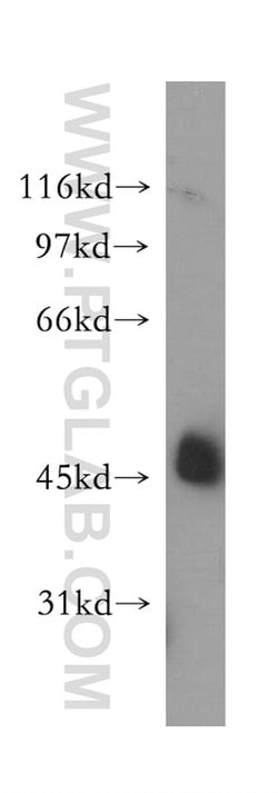 STOML1 Rabbit anti-Human, Mouse, Rat, Polyclonal, Proteintech:Antibodies:Primary