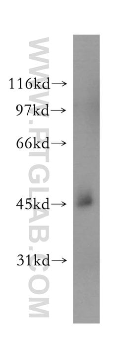 STOML1 Rabbit anti-Human, Mouse, Rat, Polyclonal, Proteintech:Antibodies:Primary