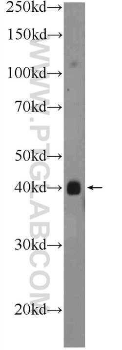 PHC2 Rabbit anti-Human, Mouse, Rat, Polyclonal, Proteintech 150 &mu;L;