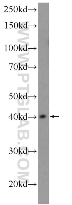 PHC2 Rabbit anti-Human, Mouse, Rat, Polyclonal, Proteintech 150 &mu;L;