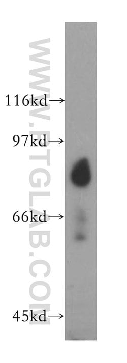 SH2D3C Rabbit anti-Human, Mouse, Rat, Polyclonal, Proteintech 150 &mu;L;