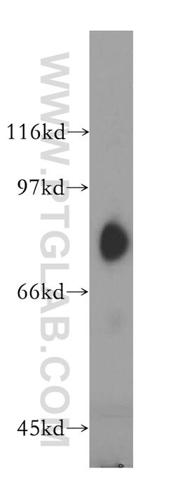 SH2D3C Rabbit anti-Human, Mouse, Rat, Polyclonal, Proteintech 150 &mu;L;