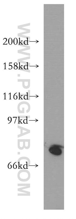 SH2D3C Rabbit anti-Human, Mouse, Rat, Polyclonal, Proteintech 150 &mu;L;