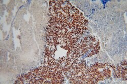 TDP-43 (C-terminal) Rabbit anti-Human, Mouse, Rat, Polyclonal, Proteintech:Antibodies:Primary
