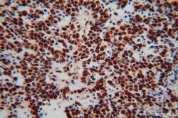 TDP-43 (C-terminal) Rabbit anti-Human, Mouse, Rat, Polyclonal, Proteintech:Antibodies:Primary