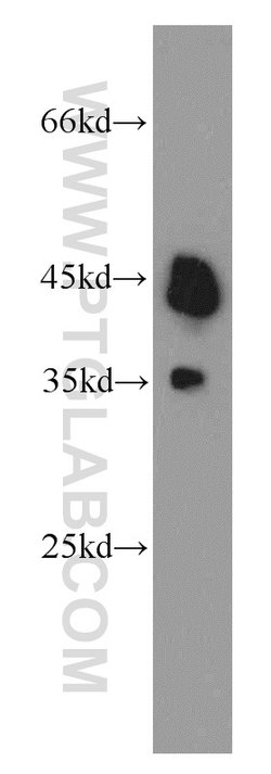 TDP-43 (C-terminal) Rabbit anti-Human, Mouse, Rat, Polyclonal, Proteintech:Antibodies:Primary
