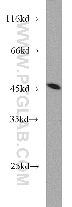 TDP-43 (C-terminal) Rabbit anti-Human, Mouse, Rat, Polyclonal, Proteintech:Antibodies:Primary