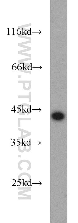 TDP-43 (C-terminal) Rabbit anti-Human, Mouse, Rat, Polyclonal, Proteintech:Antibodies:Primary