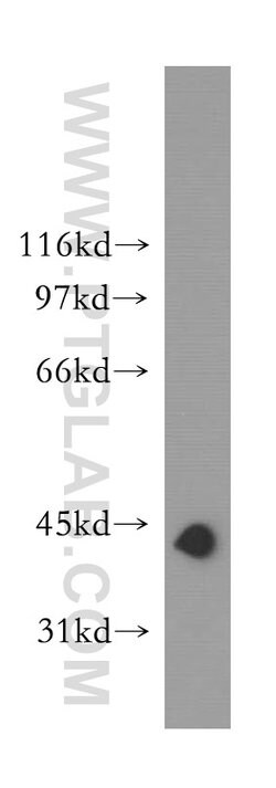 TDP-43 (C-terminal) Rabbit anti-Human, Mouse, Rat, Polyclonal, Proteintech:Antibodies:Primary