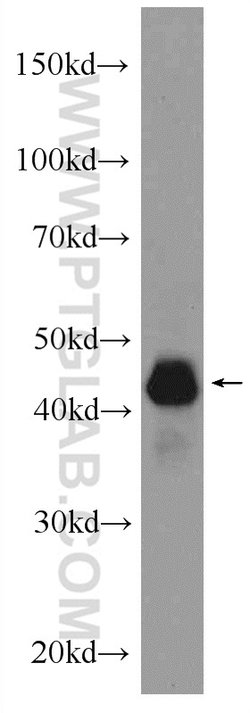 TDP-43 (C-terminal) Rabbit anti-Human, Mouse, Rat, Polyclonal, Proteintech:Antibodies:Primary