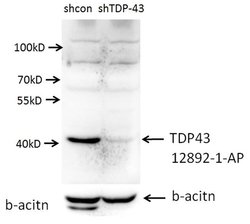 TDP-43 (C-terminal) Rabbit anti-Human, Mouse, Rat, Polyclonal, Proteintech:Antibodies:Primary