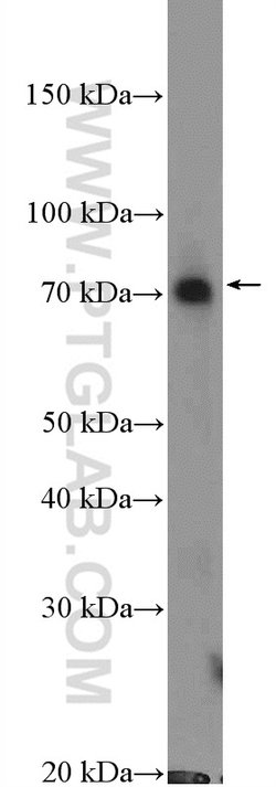 RPN1 Rabbit anti-Human, Mouse, Rat, Polyclonal, Proteintech 150 &mu;L;