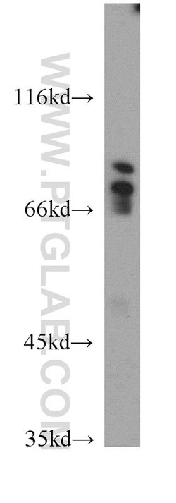 DTL Rabbit anti-Human, Mouse, Rat, Polyclonal, Proteintech 150 &mu;L; Unconjugated:Antibodies,