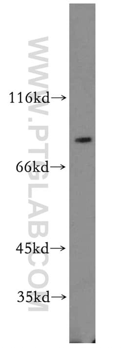 DTL Rabbit anti-Human, Mouse, Rat, Polyclonal, Proteintech 150 &mu;L; Unconjugated:Antibodies,