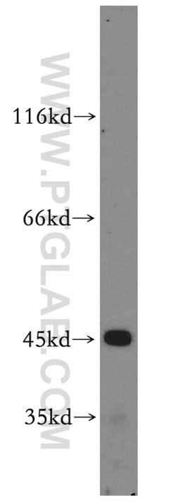 CYP2W1 Rabbit anti-Human, Mouse, Rat, Polyclonal, Proteintech:Antibodies:Primary