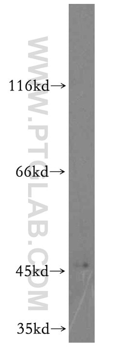 CYP2W1 Rabbit anti-Human, Mouse, Rat, Polyclonal, Proteintech:Antibodies:Primary