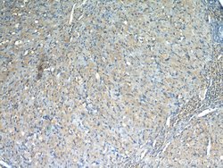 THADA Rabbit anti-Human, Mouse, Rat, Polyclonal, Proteintech:Antibodies:Primary