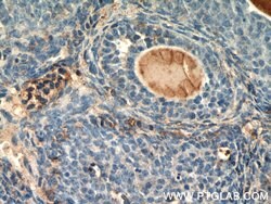 THADA Rabbit anti-Human, Mouse, Rat, Polyclonal, Proteintech:Antibodies:Primary