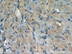 THADA Rabbit anti-Human, Mouse, Rat, Polyclonal, Proteintech:Antibodies:Primary