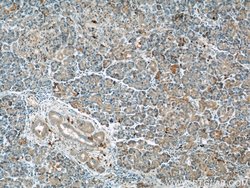 THADA Rabbit anti-Human, Mouse, Rat, Polyclonal, Proteintech:Antibodies:Primary
