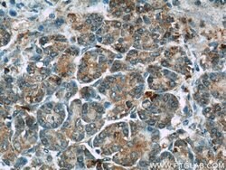 THADA Rabbit anti-Human, Mouse, Rat, Polyclonal, Proteintech:Antibodies:Primary