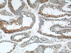 THADA Rabbit anti-Human, Mouse, Rat, Polyclonal, Proteintech:Antibodies:Primary