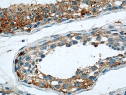 THADA Rabbit anti-Human, Mouse, Rat, Polyclonal, Proteintech:Antibodies:Primary